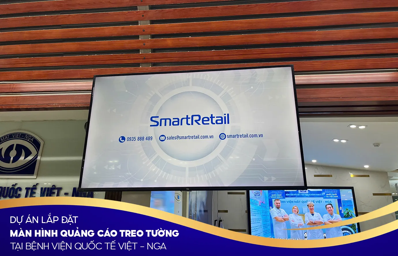 Tư vấn & báo giá tại SmartRetail | SmartRetail Tư vấn & báo giá tại SmartRetail